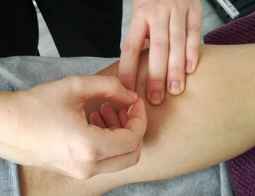 Puncion Seca